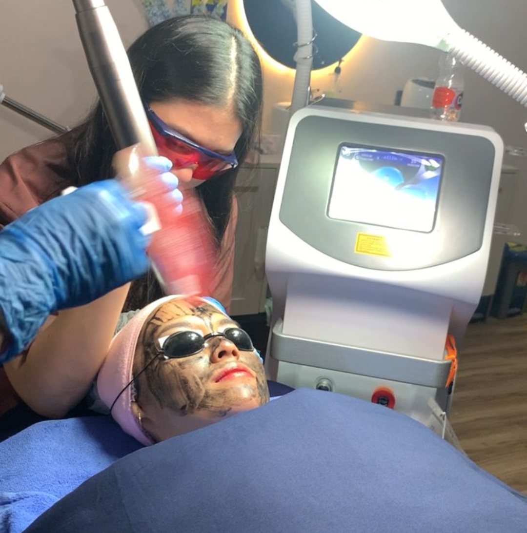 Mau Hilangkan Jerawat Hingga Nose Threadlift, Aethernic Skin and Aesthetic Clinic Punya Caranya