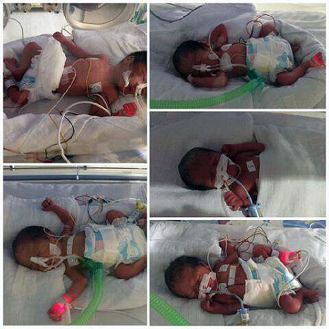 Warga Cirebon Lahirkan Bayi Kembar 5, Diberi Inisial Nama AIUEO