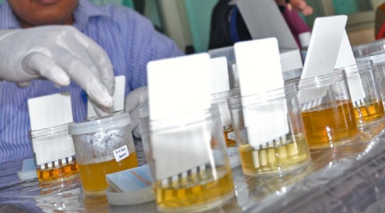 Test Urine, Ada PNS Gedung Sate Pakai Narkoba