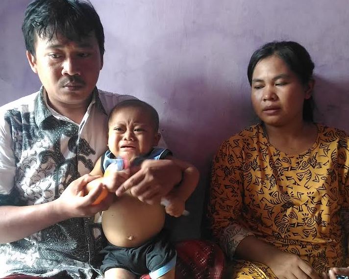 Tak Punya Biaya, Bayi Penderita Tumor Ini Batal Jalani Kemoterapi