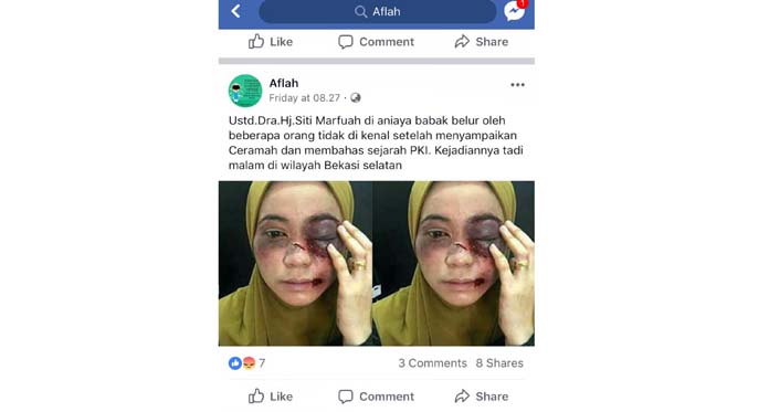 Postingan Ustadah Dianiaya Ternyata Hoax, Faktanya Efek Make-up