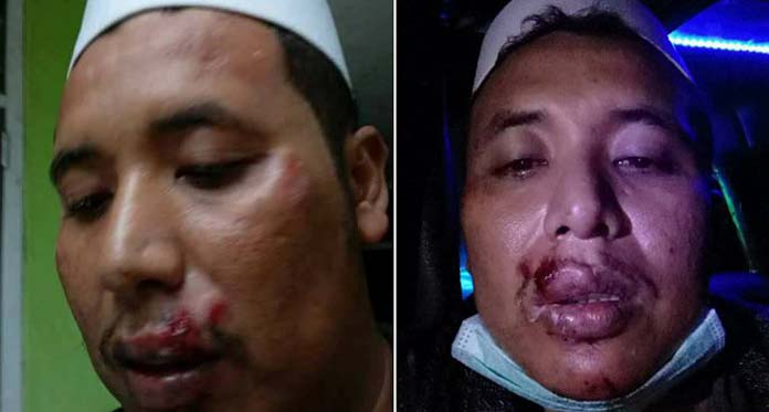 Usai Ceramah, Ketua FPI Bogor Dipukul Orang Pendukung PKI