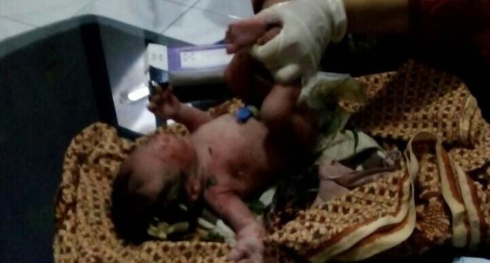 Geger! Bayi Perempuan Ditemukan di Semak-Semak Dekat Tol Cipali