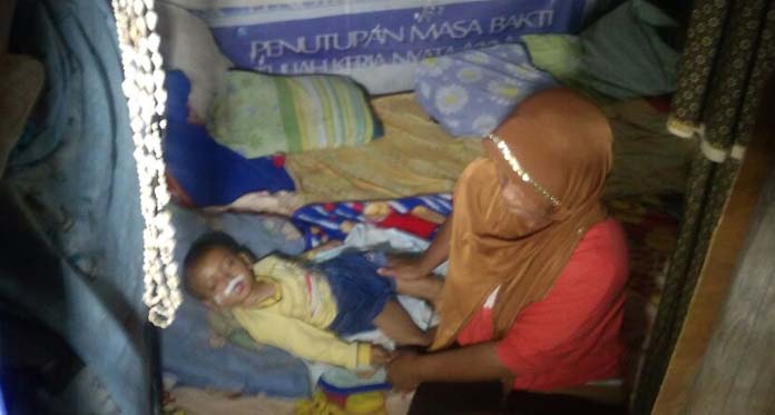 Tak Punya Biaya Berobat, Bocah Penderita Meningitis Terkulai Lemah