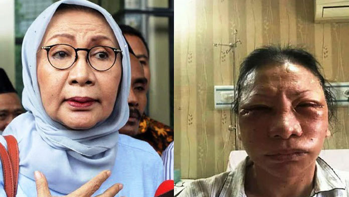 Ratna Sarumpaet Dipukuli Orang, Polisi Belum Terima Laporan