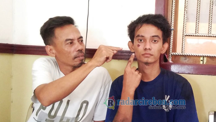 Dipukuli Kakak Ipar Hingga Berdarah, Lapor Polisi