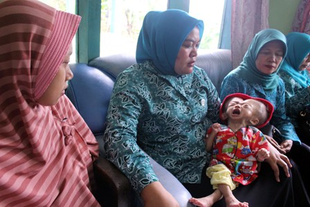 Bayi 21 Bulan Menderita Hydrosefalus, Kontrol ke RS Terkendala Biaya