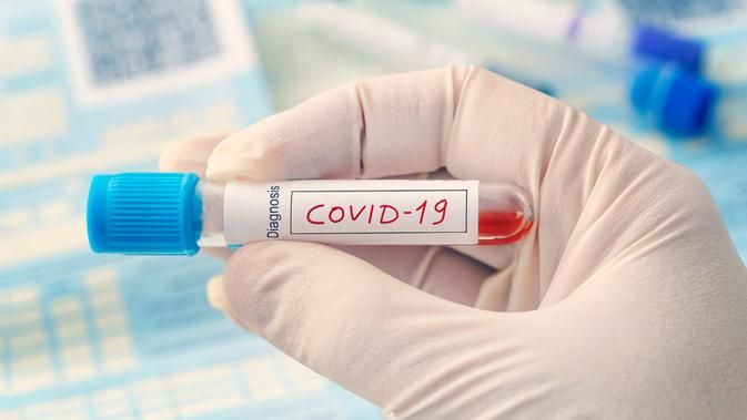 Hasil Swab Positif Covid-19, Tenaga Medis dan Keluarga Terkontak Lakukan Rapid Test