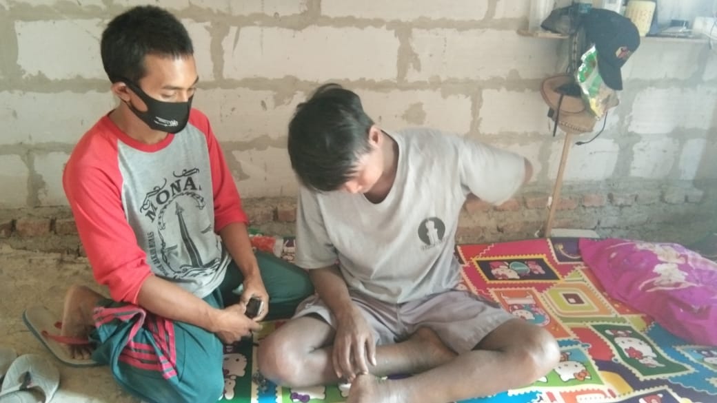 Alhamdulillah, Remaja yang Menderita Penyakit Kulit Bersisik di Sekujur Tubuh Kini Membaik