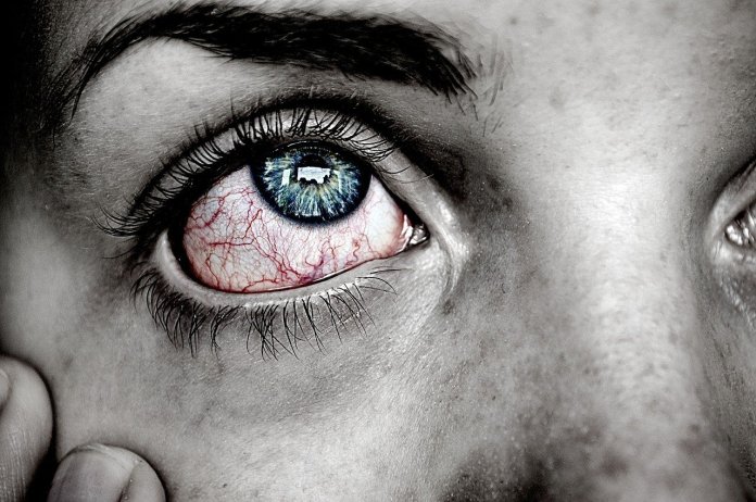 Bahaya Glaukoma yang Muncul Tanpa Gejala, Begini Penjelasannya