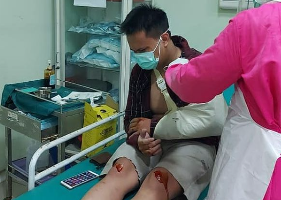 Jadi Korban Jalan Berlubang di Kota Cirebon, Pria Ini Patah Tulang Selengkangan