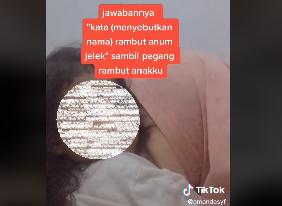 Prihatin! Balita Gunting Rambut Sendiri karena Di-bully