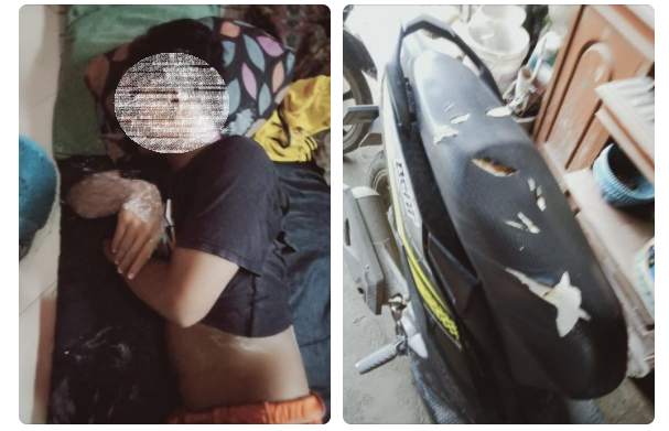 Cerita Korban Diserang Geng Motor di Jamblang