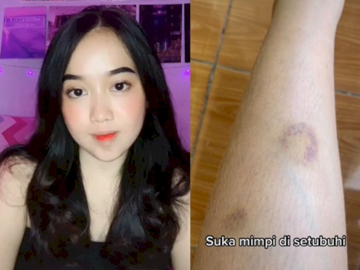 Gadis Cantik Mengaku Disukai Mahluk Gaib, Mimpi Disetubuhi hingga Memar