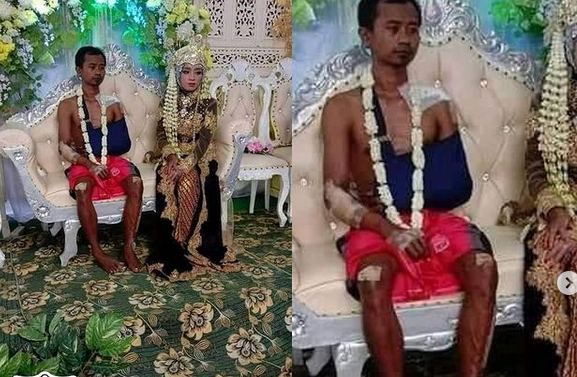 Pengantin Pria Hanya Pakai Kolor saat Resepsi, Rupanya Kecelakaan sebelum Pernikahan