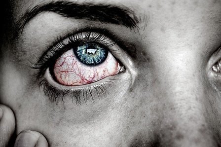 Mata Gatal Bikin Gak Nyaman, Ini Cara Mengatasinya