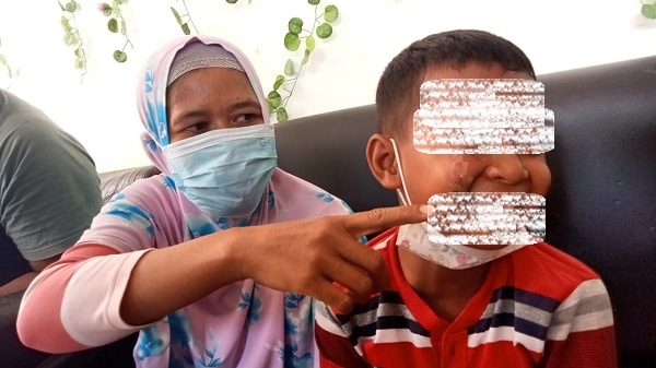 Penganiayaan Anak Ditempel Knalpot di Kapetakan, Pemdes Berharap Selesai Kekeluargaan