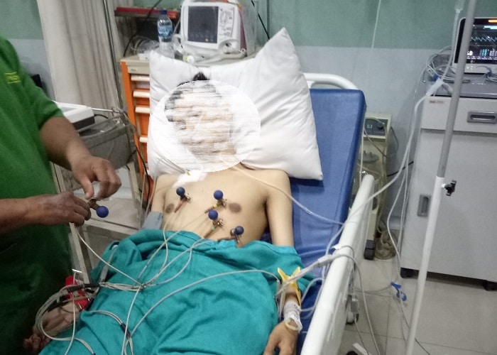 Penembakan di Jalan Harapan Kesambi, Polresta Cirebon: Target Operasi Pelaku Curas