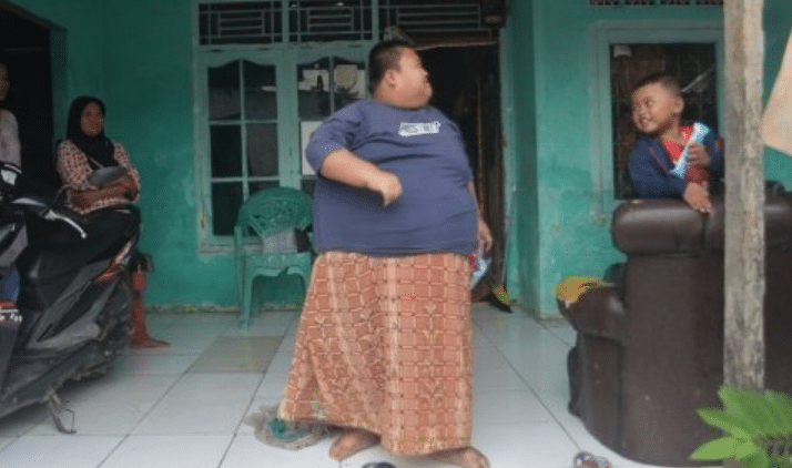 Tragis! Perjuangan Rafka Adi Melawan Obesitas sampai Meninggal, Pernah Divonis Kurang Gizi