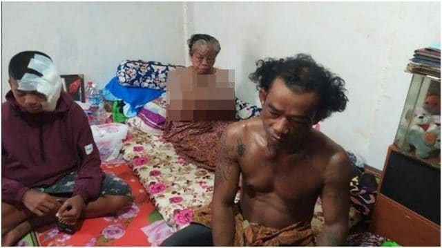 Satu Keluarga Disiram Air Keras di Palembang, Pelakunya 20 Orang