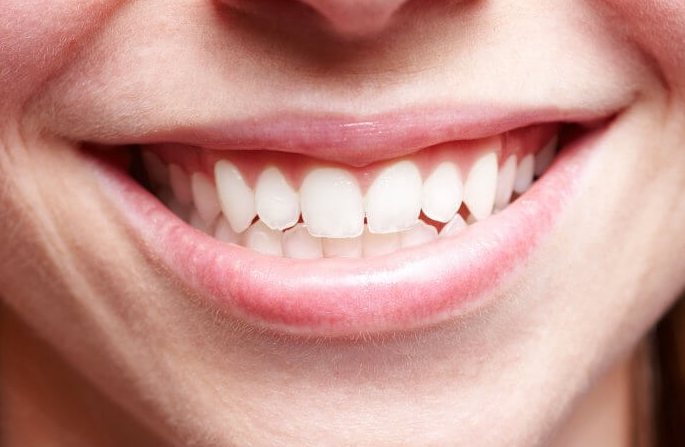 5 Cara Menghilangkan Karang Gigi yang Mudah, Tangani Sebelum Kronis