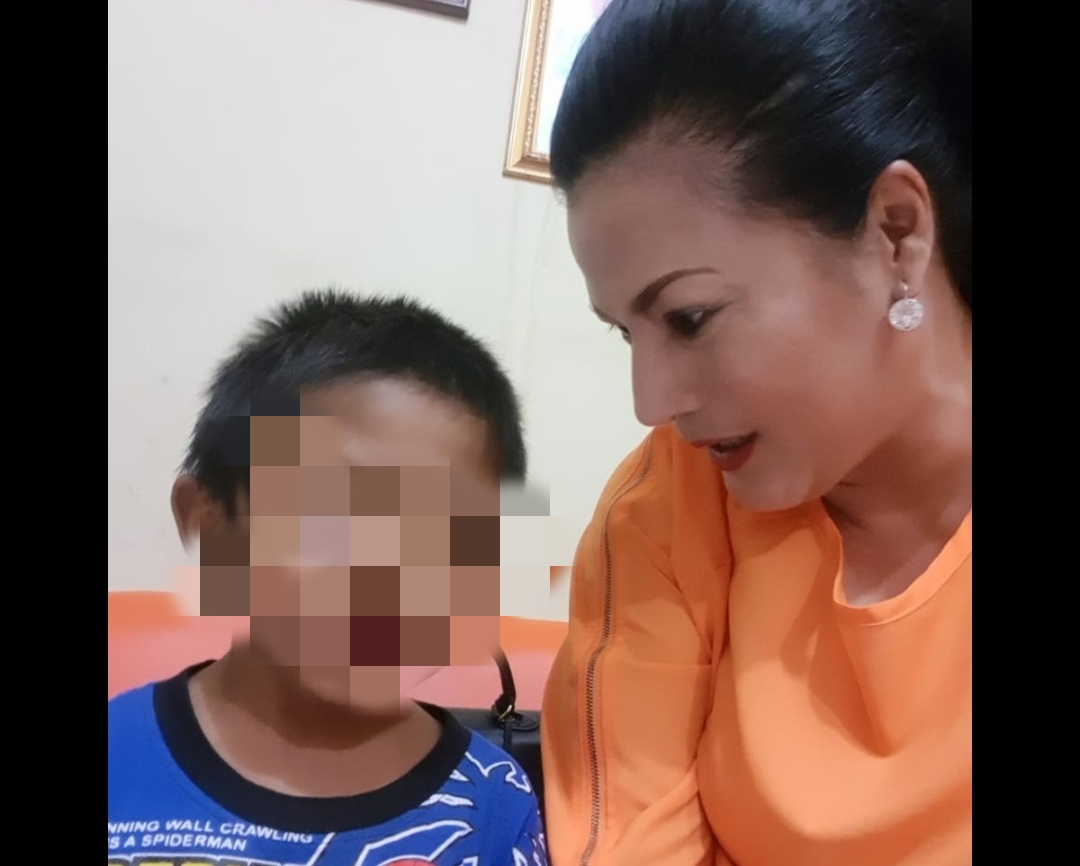 Dugaan Penganiayaan Anak Angkat di Pabuaran Cirebon, Tubuh Banyak Bekas Luka