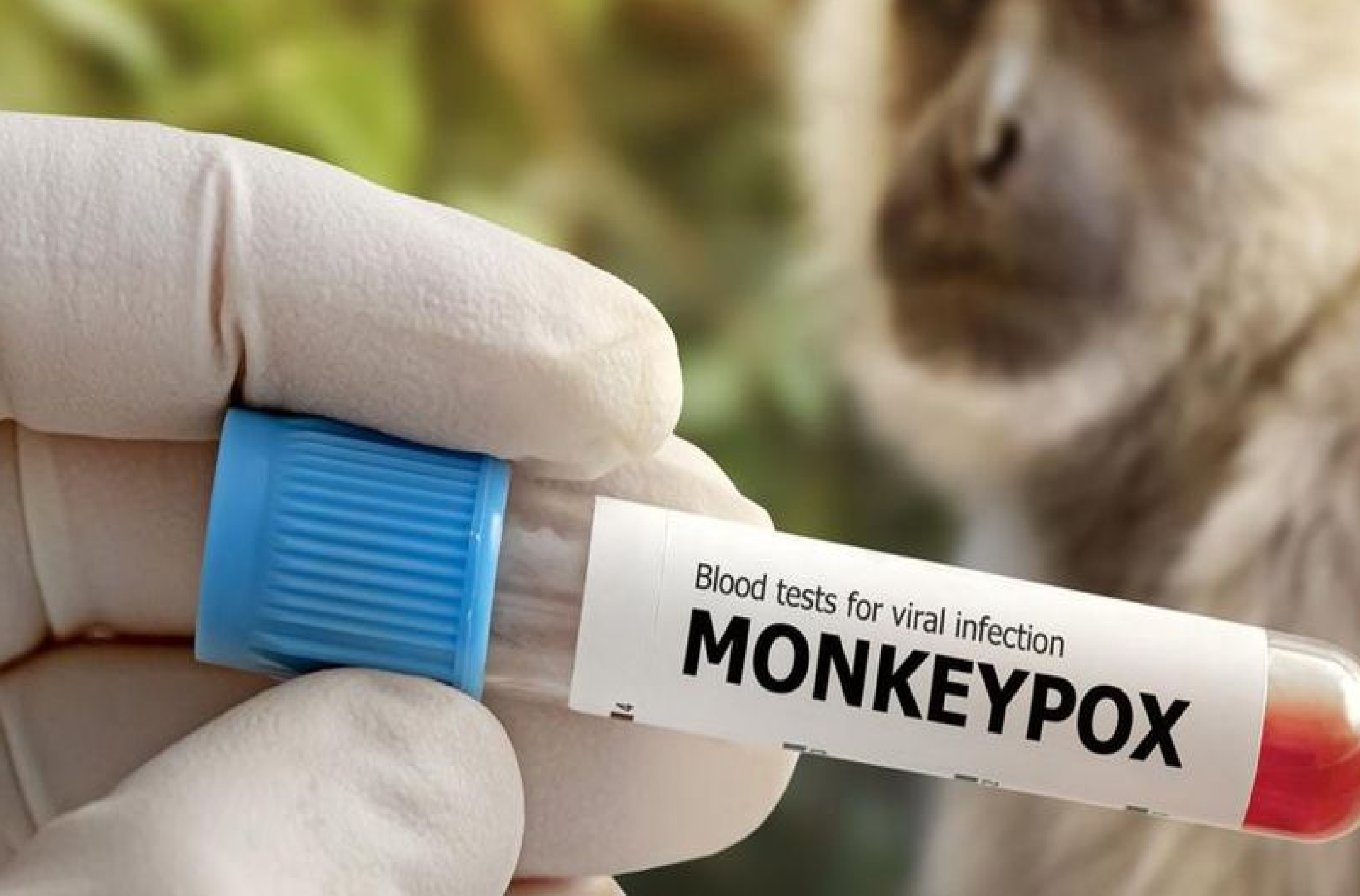 Sejumlah Langkah Dilakukan Kemenkes untuk Tangani Penyebaran Monkeypox