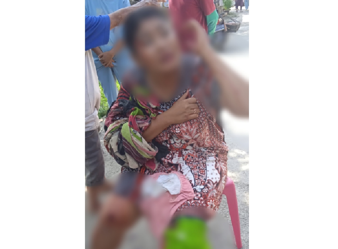 Tak Mau Diajak Rujuk, Wanita Asal Girinata Cirebon Nyaris Dibunuh oleh Mantan Suaminya