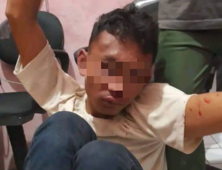 Pelaku Curanmor di Kedawung Cirebon Ditangkap, Wajah Babak Belur