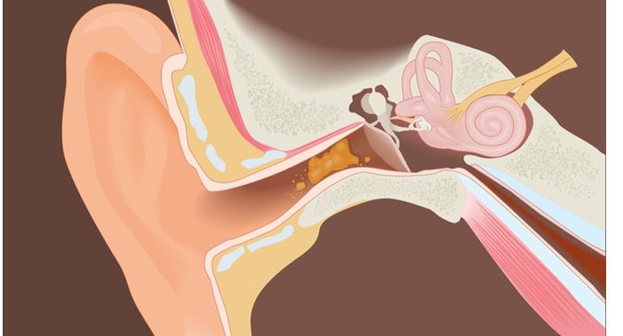 Mengungkap Fakta: Kenapa Tahi Telinga Pahit?