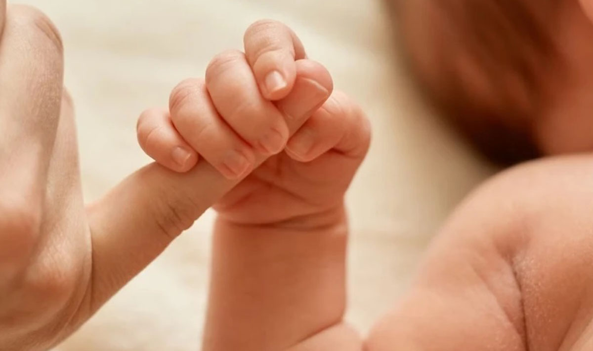 Bayi Kembar asal Ciawigajah alami Perut Dempet, Tidak Terdeteksi Sewaktu USG