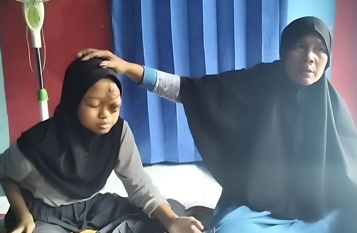 Gadis Penderita Tumor di Kuningan Kerap Dibully, Kini Mogok Sekolah