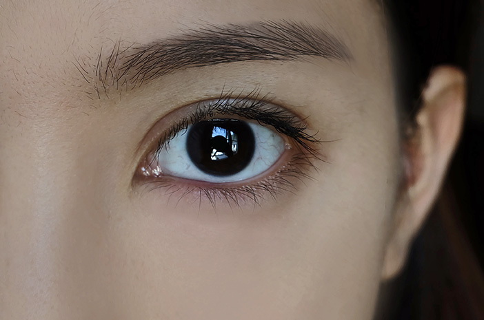 Mata Anda Sakit Saat Anda Mengedipkan Mata, Ketahuilah 7 Penyebab dan Cara Cara Mengatasinya