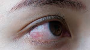 Menjaga Retina Adalah Salah Satu Kunci Mata yang Sehat