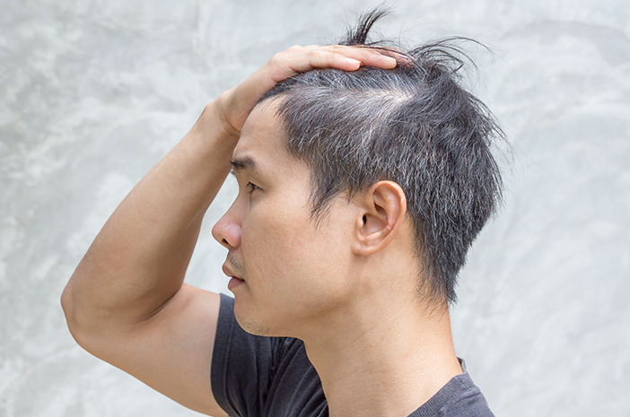 7 Penyebab Rambut Beruban di Usia yang Relatif Muda yang Penting Untuk Diketahui