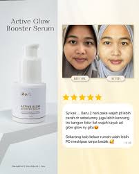 Kulit Nggak Cukup Dirawat, Harus Di-Boost