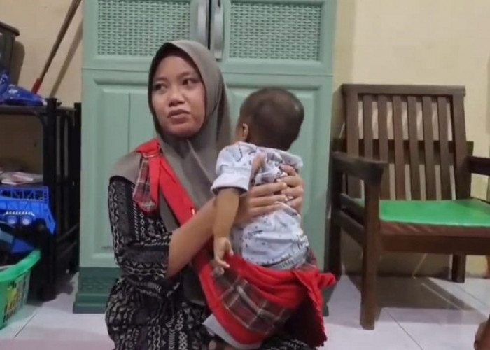 Derita Bayi 8 Bulan Asal Cirebon Idap Atresia Bilier, Transplantasi Hati Jadi Satu-satunya Harapan