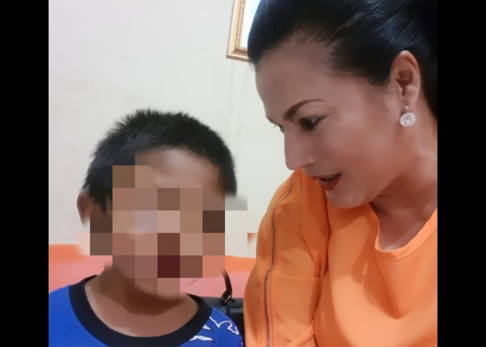 Dugaan Penganiayaan Anak Angkat di Pabuaran Cirebon, Tubuh Banyak Bekas Luka