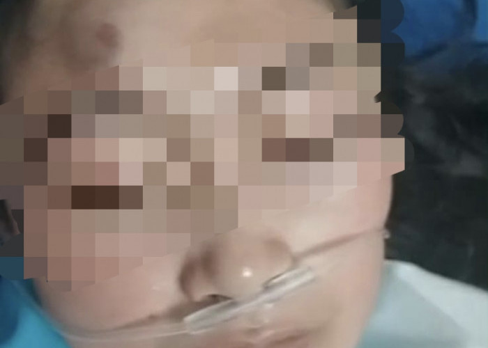 Ditolak Cinta, Dokter Spesialis Diduga Aniaya Perawat di Cirebon hingga Nyaris Pingsan