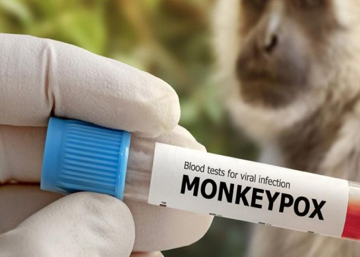 Sejumlah Langkah Dilakukan Kemenkes untuk Tangani Penyebaran Monkeypox