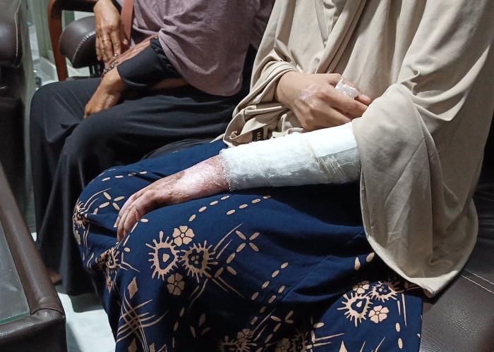 Didampingi Tim Hotman 911, Wanita Cirebon Ungkap Dugaan Kekerasan Brutal oleh Oknum Polisi