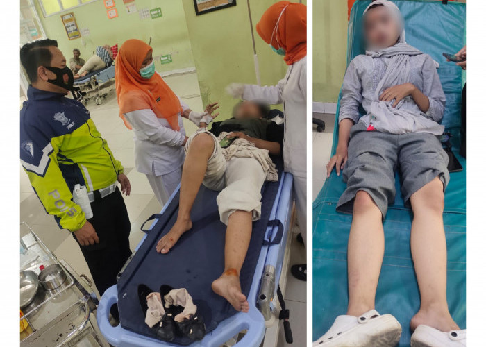 Diduga Kurang Konsentrasi, Dua Remaja Putri Kecelakaan di Pantura Cirebon