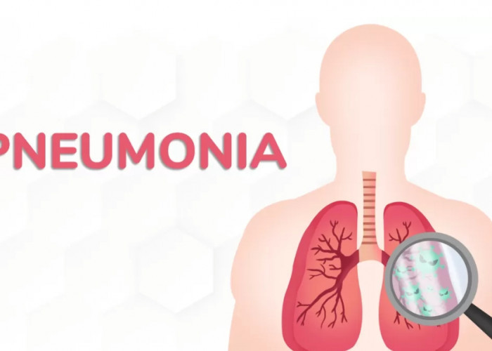 Perlu Diingat! 5 Penyebab Pneumonia yang Menjadi Kebiasaan Sehari-hari 