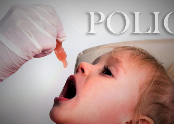 Kasus terbaru penyakit lumpuh layu ditemukan di Indonesia, Jangkiti 3 Anak
