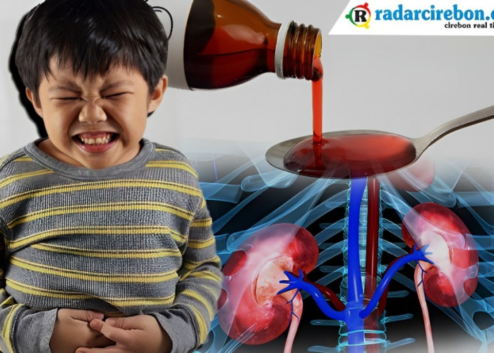 3 Obat Sirup Berbahaya untuk Anak dan Penyebab Gagal Ginjal Akut