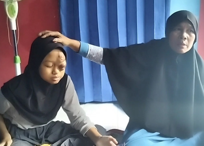 Gadis Penderita Tumor di Kuningan Kerap Dibully, Kini Mogok Sekolah