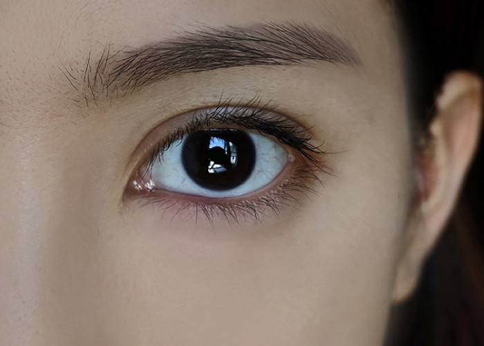 Mata Anda Sakit Saat Anda Mengedipkan Mata, Ketahuilah 7 Penyebab dan Cara Cara Mengatasinya