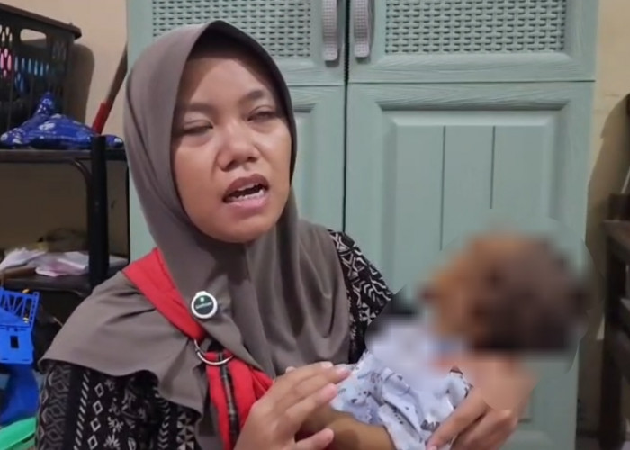 Perut Membesar hingga 58 Cm, Balita Asal  Cirebon Ini Butuh Cangkok Hati Segera