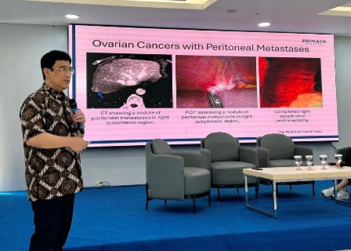 HIPEC Hadir di Primaya Hospital Kelapa Gading,Terapi Canggih Tingkatkan Harapan Hidup Pasien Kanker Peritoneal