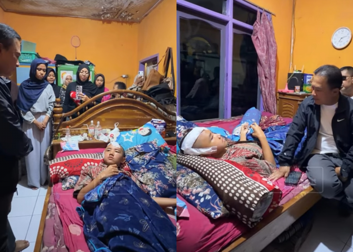 30 Jahitan di Kepala Siswa SMP Kuningan, Bupati Beri Peringatan Keras